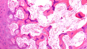 Medical tissue in microscope